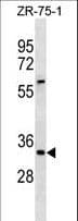 ING2 Antibody (aa112-141)