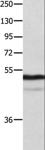 NAP1L1 Antibody