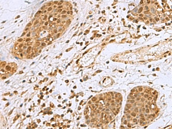 NVL Antibody