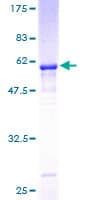 Human SSR1 Protein (Recombinant GST)