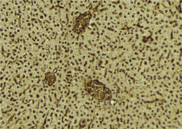 BRD3 Antibody