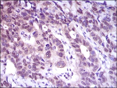 Monoclonal Mouse anti-Human ACLY / ATP Citrate Lyase Antibody (clone 5F8D11, IHC, IF, WB)
