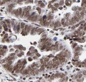 RCC1 Antibody (phospho-Ser12)