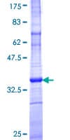 Human ARL6IP5 Protein (Recombinant GST, N-terminus)