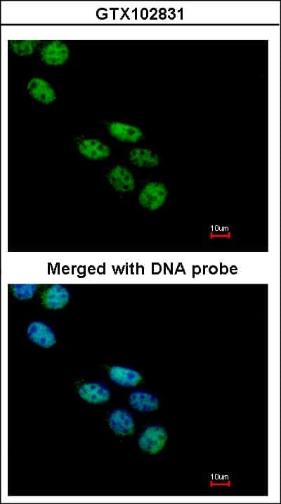 IHC-plus™ NOVA1 Antibody (C-Terminus)