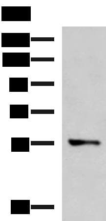 TEKT5 Antibody