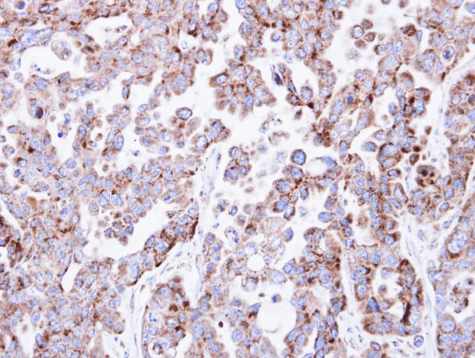NDUFV2 Antibody (aa1-249)