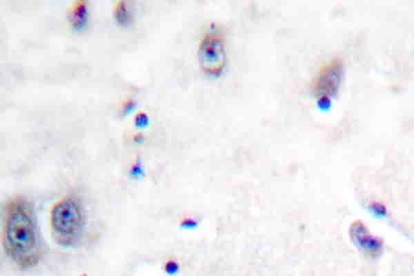 GABRB1 Antibody (phospho-Ser434)