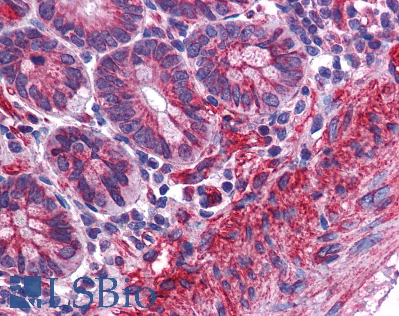 IHC-plus™ Polyclonal Rabbit anti-Human MTCH2 Antibody (IHC, IF, WB)