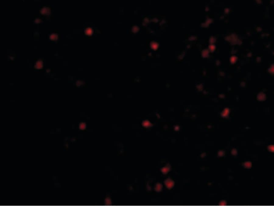 IHC-plus™ Polyclonal Rabbit anti-Human IKBKAP / IKAP Antibody (IHC, IF, WB)