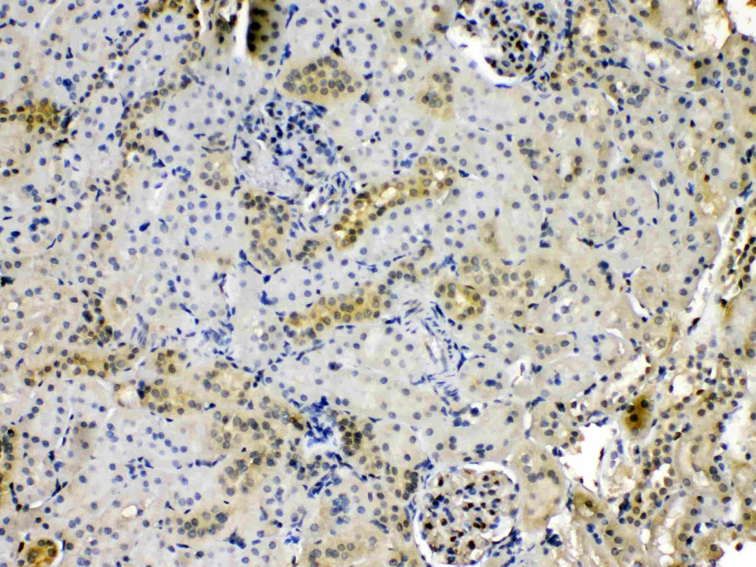 Polyclonal Rabbit anti-Human PNP / Nucleoside Phosphorylase Antibody (IHC, WB)