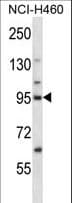KIF2C / MCAK Antibody (aa180-208)