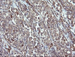 PHF7 Antibody (aa155-381, clone OTI1A2)