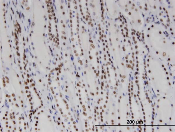 Monoclonal Mouse anti-Human DDX11 / CHLR1 Antibody (clone 3C1, IHC, WB)