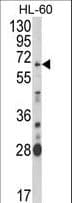 Polyclonal Rabbit anti-Human ARSB / Arylsulfatase B Antibody (aa235-266, WB)