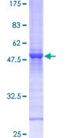 Human RAB6A / RAB6 Protein (Recombinant GST)
