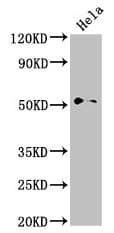 NR0B1 / DAX1 Antibody