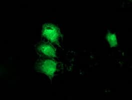MGLL / Monoacylglycerol Lipase Antibody (clone OTI1C6)