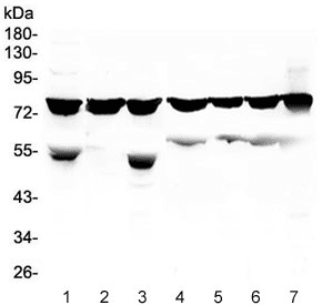 PRKCB / PKC-Beta Antibody