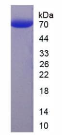 Human HABP2 Protein (Recombinant His, N-Terminal)