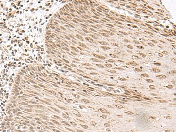 Polyclonal Rabbit anti-Human GAL4 / Galectin 4 Antibody (IHC, WB)
