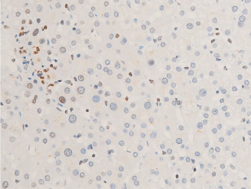 Polyclonal Rabbit anti-Human ERBB2 / HER2 Antibody (phospho-Tyr1112, IHC, IF, WB)