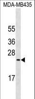 EMA / MUC1 Antibody