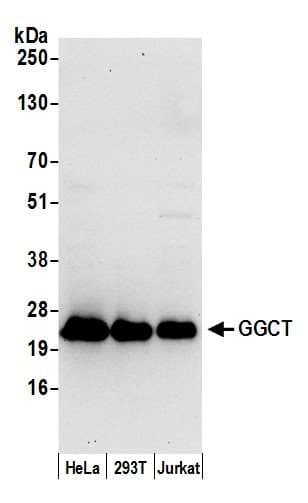 Polyclonal Rabbit anti-Human GGCT Antibody (aa138-188, WB)