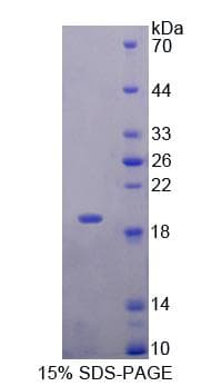 Human NENF / Neudesin Protein (Recombinant His-T7)