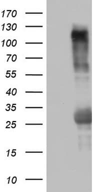 Monoclonal Mouse anti-Human TRIM24 / TIF1 Antibody (clone OTI1G5, aa706-1016, WB)