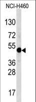 Polyclonal Rabbit anti-Human TFAP2A / AP-2 Antibody (aa407-436, WB)