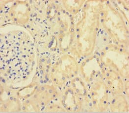 Polyclonal Rabbit anti-Human XIAP Antibody (aa1-497)