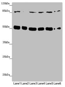 Polyclonal Rabbit anti-Human YME1L1 Antibody (IHC, WB)