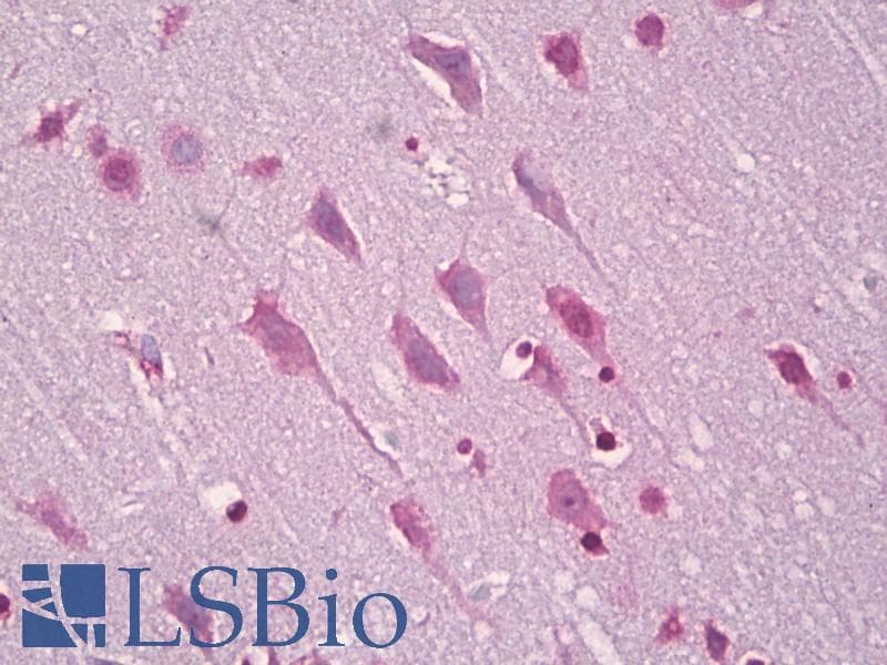 IHC-plus™ EFNA5 / Ephrin A5 Antibody (aa31-80)