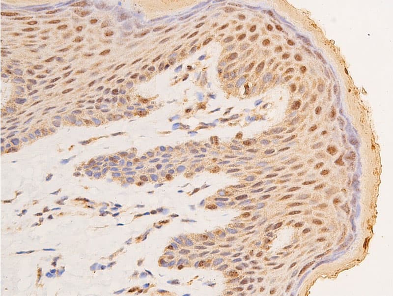 TP53 / p53 Antibody (phospho-Ser15)