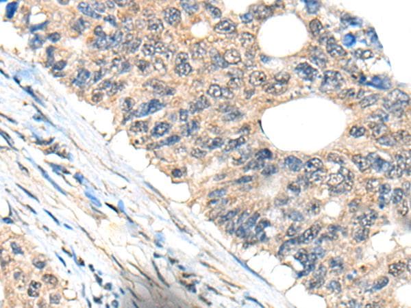 Polyclonal Rabbit anti-Human BHMT2 Antibody (IHC, WB)