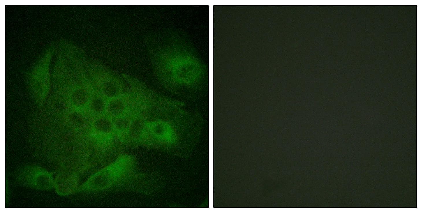 PIKFYVE / PIP5K Antibody (phospho-Ser307)
