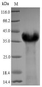 Epstein-Barr Virus LMP1 Protein (Recombinant 6His, N-terminus)