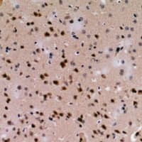 Polyclonal Rabbit anti-Human DYNC1I1 Antibody (IHC, WB)