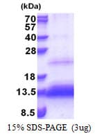 Human TRIAP1 Protein (Recombinant His)