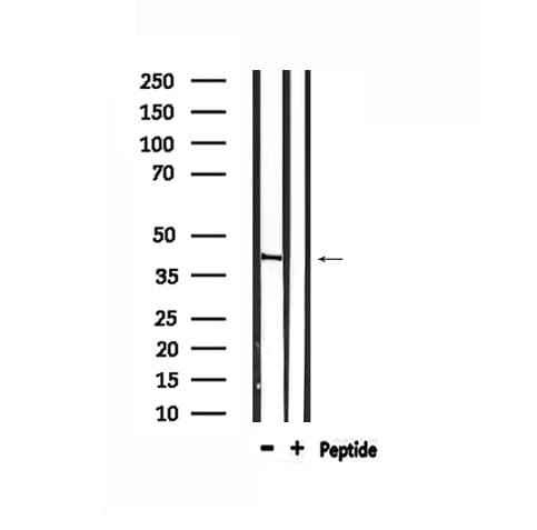 CYSLTR1 / CYSLT1 Antibody