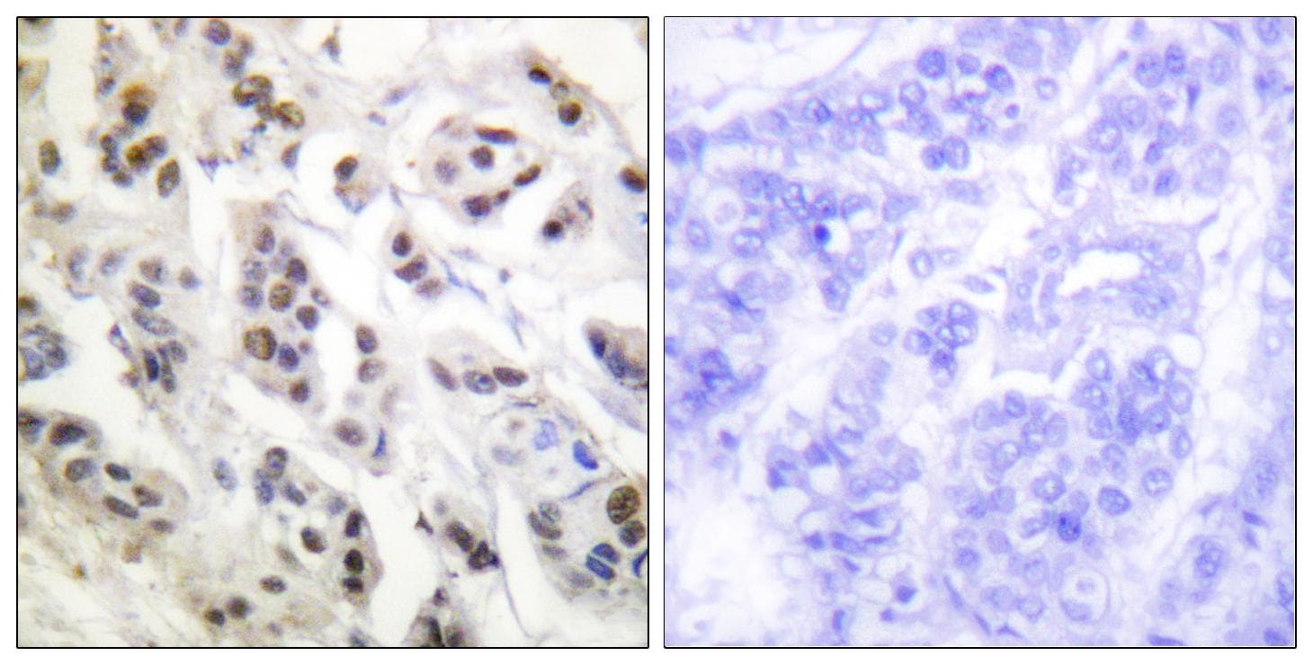 LMNA / Lamin A+C Antibody (p392)