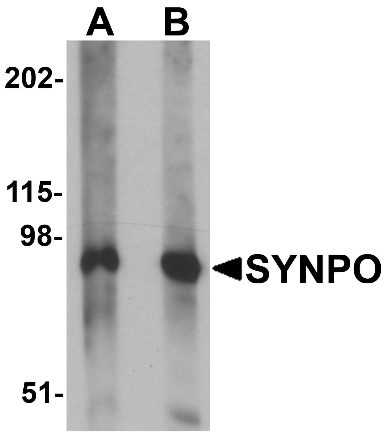 IHC-plus™ Polyclonal Rabbit anti-Human SYNPO / Synaptopodin Antibody (IHC, IF, WB)