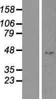 IHH Protein (Over-Expression Lysate Myc-DDK (Flag))