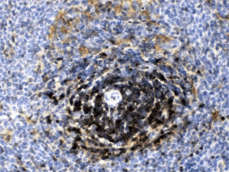 Polyclonal Rabbit anti-Human LDHB / Lactate Dehydrogenase B Antibody (IHC, WB)