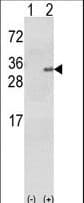 GSTA1 Antibody
