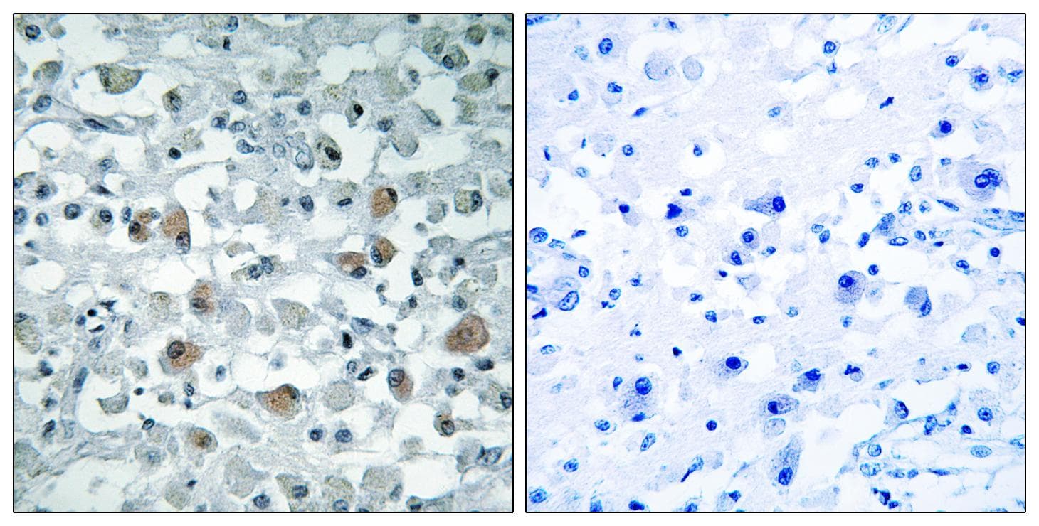 EIF1AY Antibody