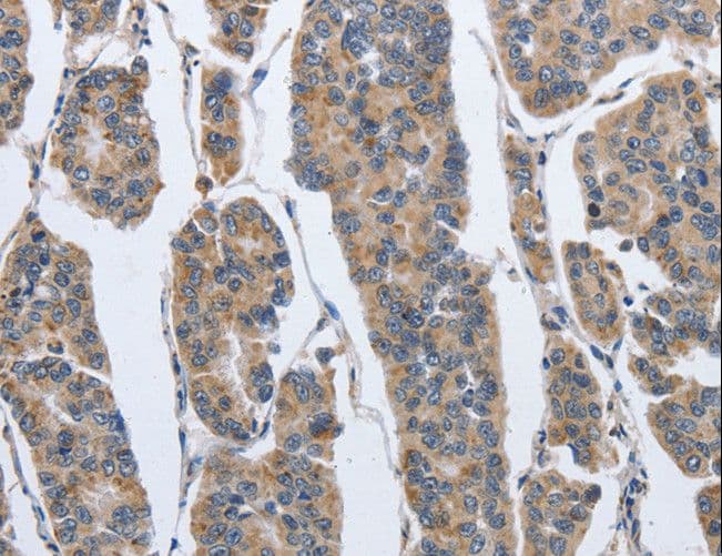IPO7 / RANBP7 Antibody