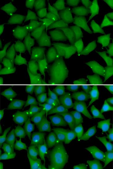 Polyclonal Rabbit anti-Human BCL2L15 Antibody (IHC, IF, WB)