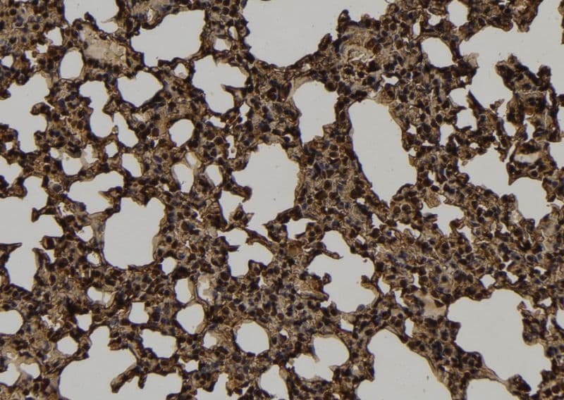 Polyclonal Rabbit anti-Human KIF4B Antibody (IHC, WB)